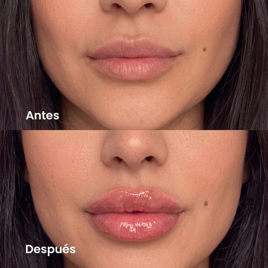 Gloss Voluminizador con Ácido Hialurónico